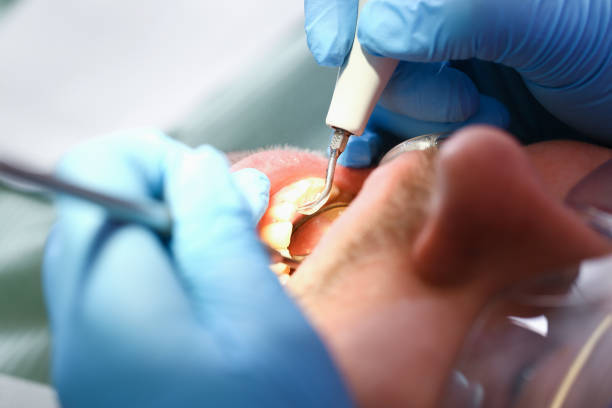 Best Emergency Root Canal Treatment in National Park, NJ