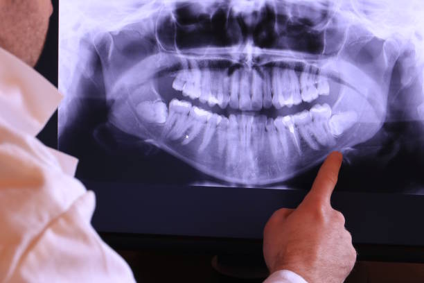 Best Emergency Broken Tooth Repair in National Park, NJ